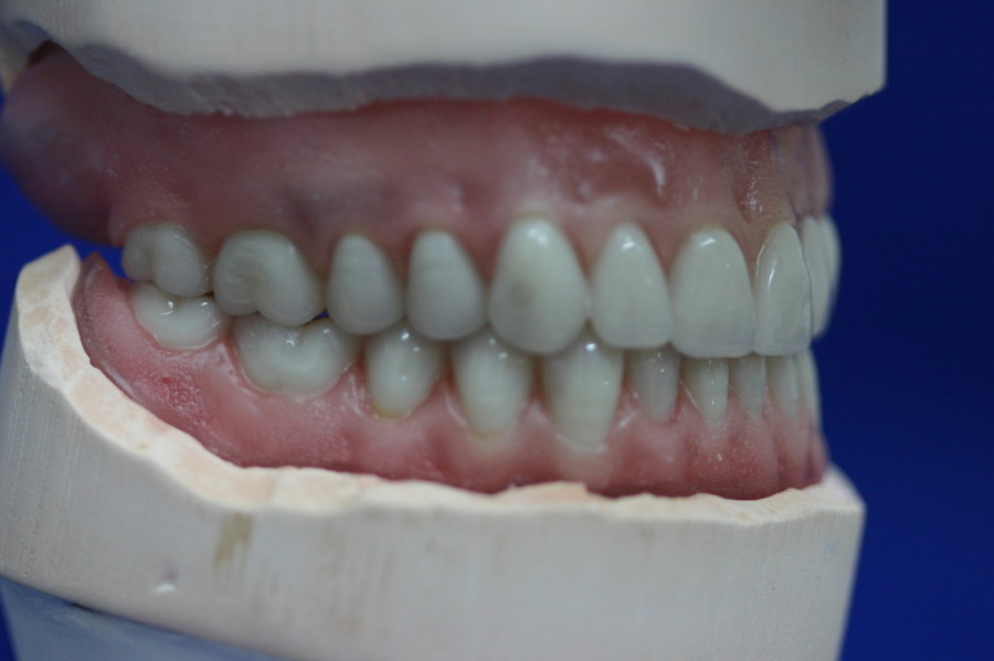 dentures denture surgical